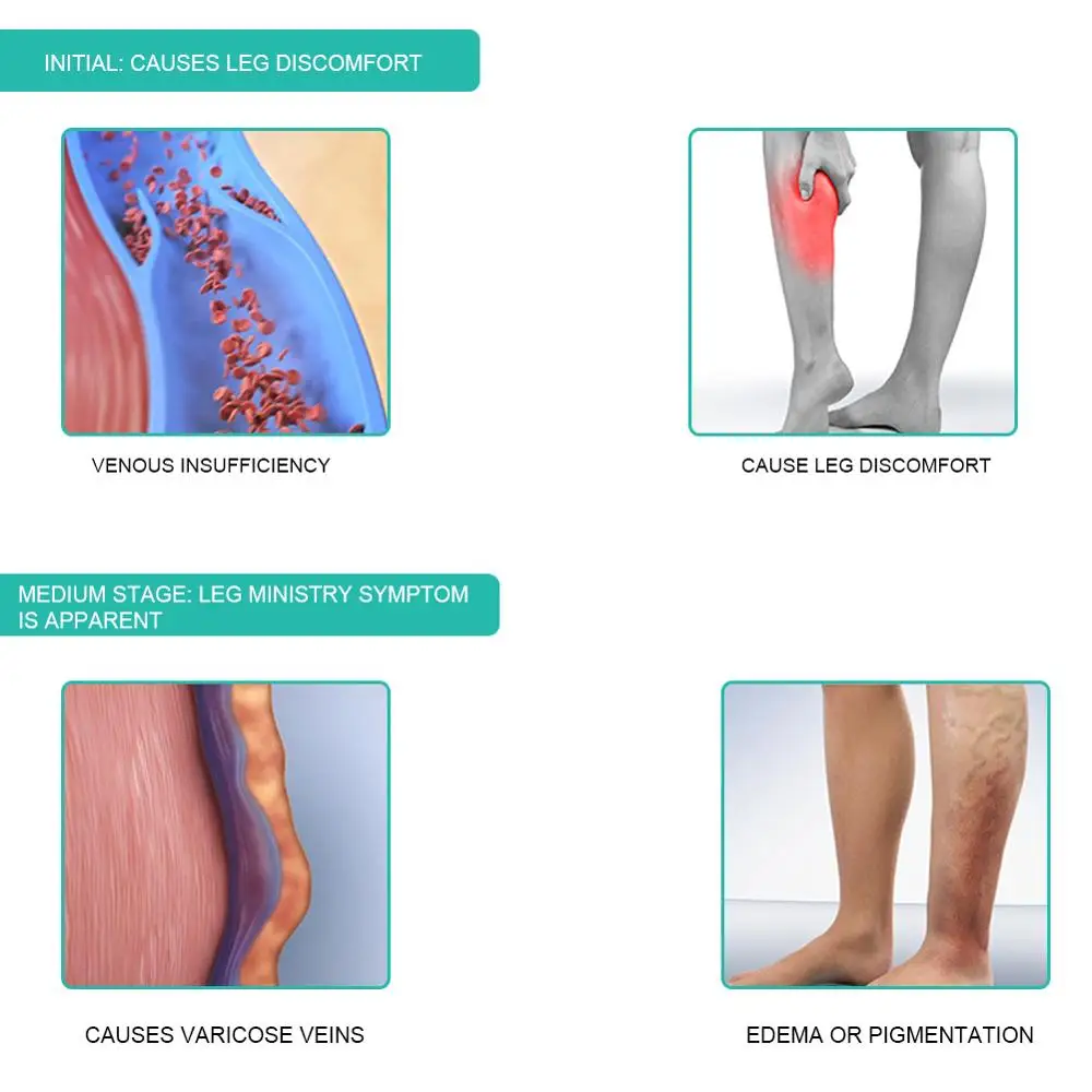 1 par de calcetines de compres - Compression Sleeve Calf reseña y precio